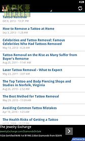 laser tattoo removal tips