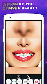 braces photo booth