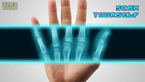 best x-ray free