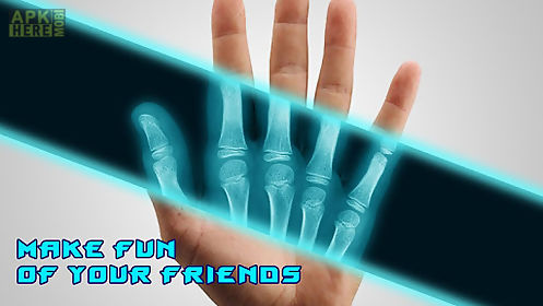 best x-ray free