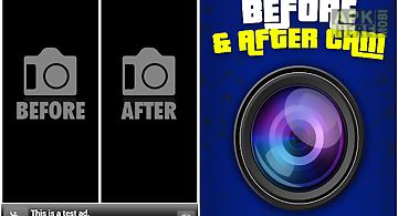 Before and after camera
