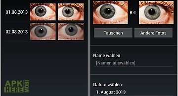 Eye diagnosis
