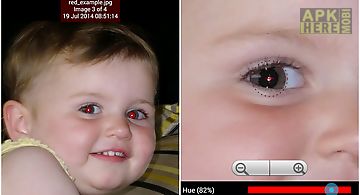 Red eye removal (free)